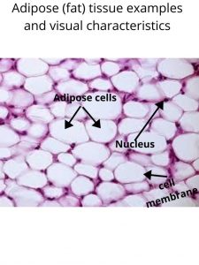 Image of adipose tissue.