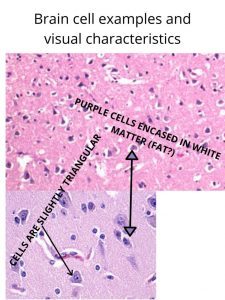 Image of a brain cell example