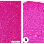 Heart tissue images