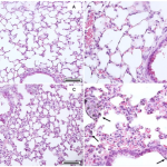 Lung tissue cell image